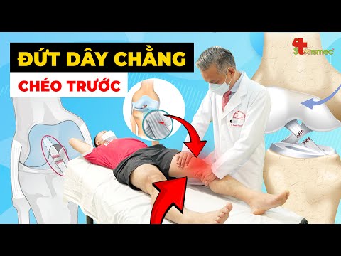 Đứt Dây Chằng Chéo Trước – Có Cần Phẫu Thuật Mới Phục Hồi Được Không?