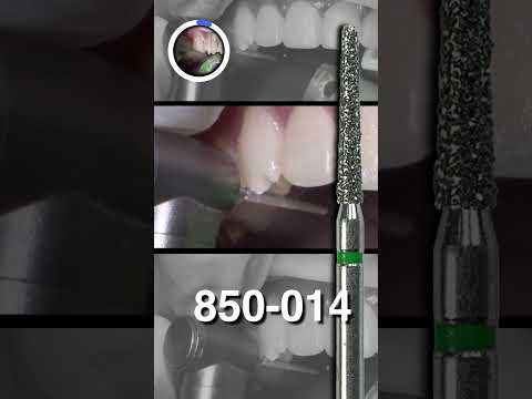 Preparing ANTERIOR Teeth for #hollywoodsmile #dentalshorts