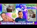 Taajuu Shurube Haala Hamtu Keessa Jira Hospital Seene Jiraa Baay Ee Dhukkubsate Jiraa Hidhati Bahee