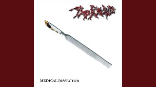 Regurgitation of Giblets (Carcass)