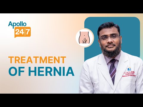 How to Get Rid of Warts Masse Dr Srabani Ghosh Zoha