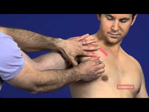 comment soulager tendinite épaule