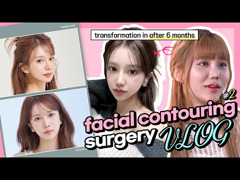 Review 6 months after 3 types facial contouring surgery, Talk about face contour surgery Q&A [EP 2]