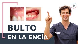 👉 ¿Sabes cómo se quita un BULTO en la ENCÍA 👄 TIPOS de bulto y CÓMO ELIMINARLOS