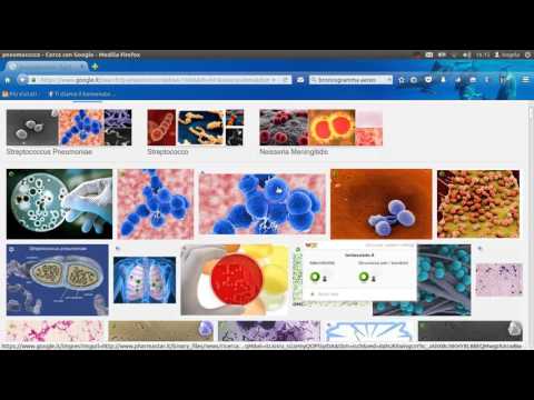 Strumento per articolazioni della mano in osteoartrite Trattamento popolare di ernia della colonna vertebrale