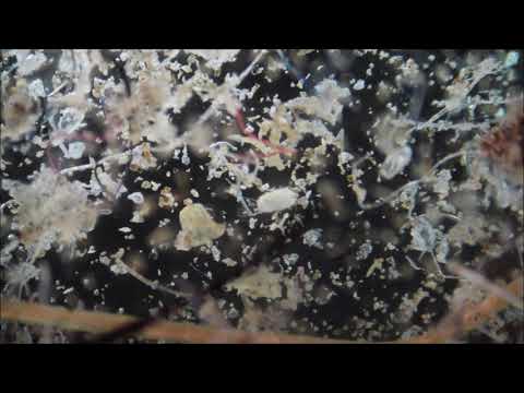 Vacuum Dust and Dust Mites Under the Microscope