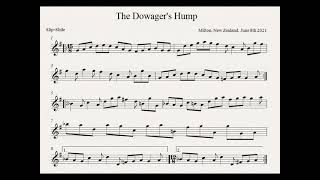 Clip of The Dowager’s Hump