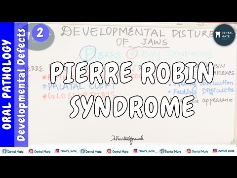 Pierre Robin Syndrome | Robin Complexes | Developmental disturbances of jaw | Dr Paridhi Agrawal