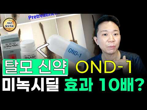 미녹시딜보다 10배 세다? 탈모 신약 OND-1 기사의 실제 진실
