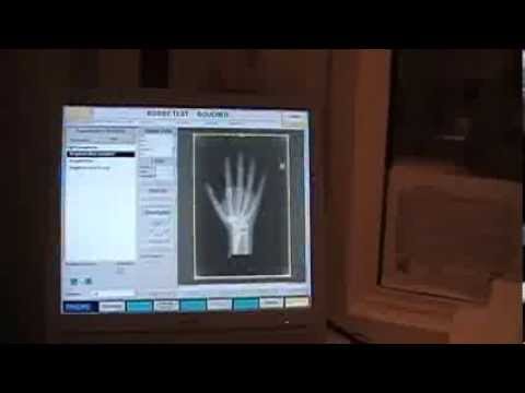comment soulager un pneumothorax