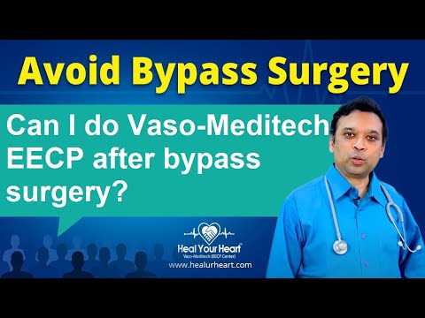 Can I do Vaso-Meditech EECP after bypass surgery?