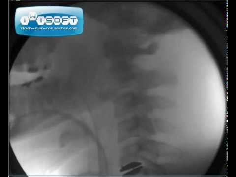 Volksheilmittel für degenerative Bandscheibenerkrankung des Hüftgelenks Gelenkprellung Zeh