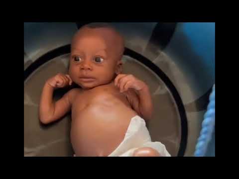 Help Nourish malnourished children food.