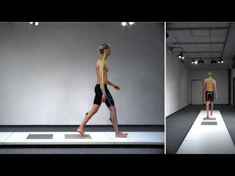 Record different views in 2D markerless // CONTEMPLAS MULTI CAMERA SYSTEM®