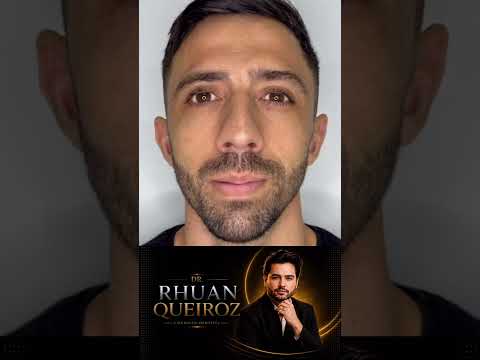😱ANTES E DEPOIS QUE CHOCOU A INTERNET, Dr Rhuan Queiroz, harmonização facial, inscreva-se!