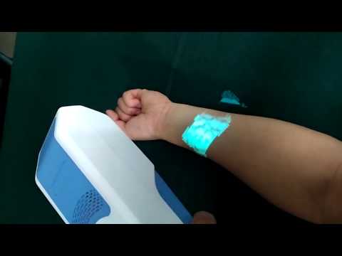 VS300 Application in real situation