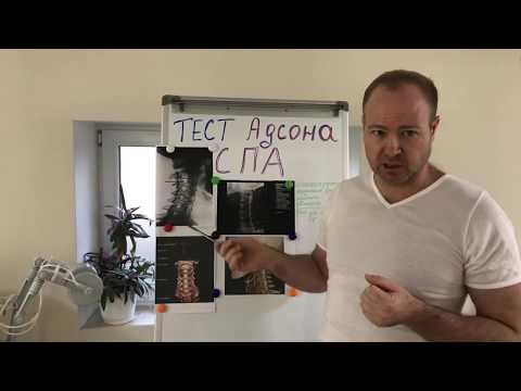 Тела позвонков грудного отдела Симптомы тянущая боль в спине