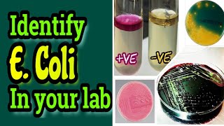 Escherichia coli (E. Coli) identification in pharmaceutical companies and medical laboratories.