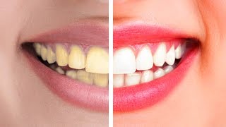 PHOTOSHOP DİŞ BEYAZLATMA - Photoshop Dersleri