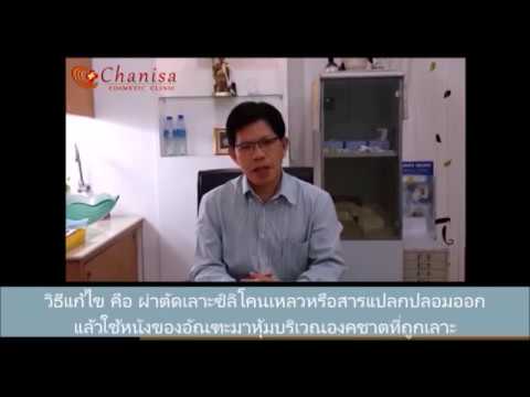 ยาพื้นบ้านชายแรง เพิ่มสมาชิกในบ้าน เงื่อนไขของ