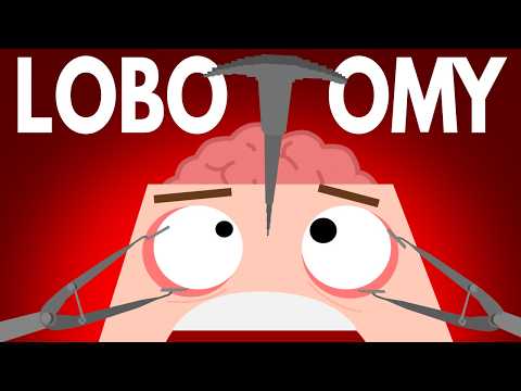 Who Do You Think Needs a Lobotomy?