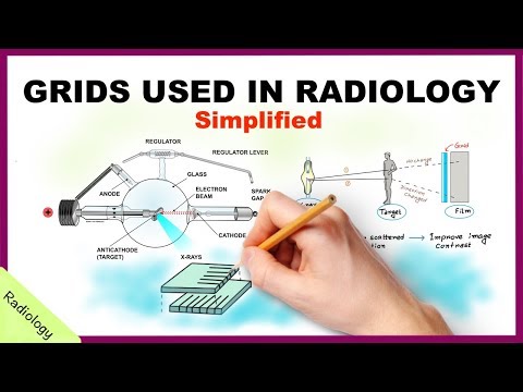 Grids Used in Radiology Simplified - Radiology