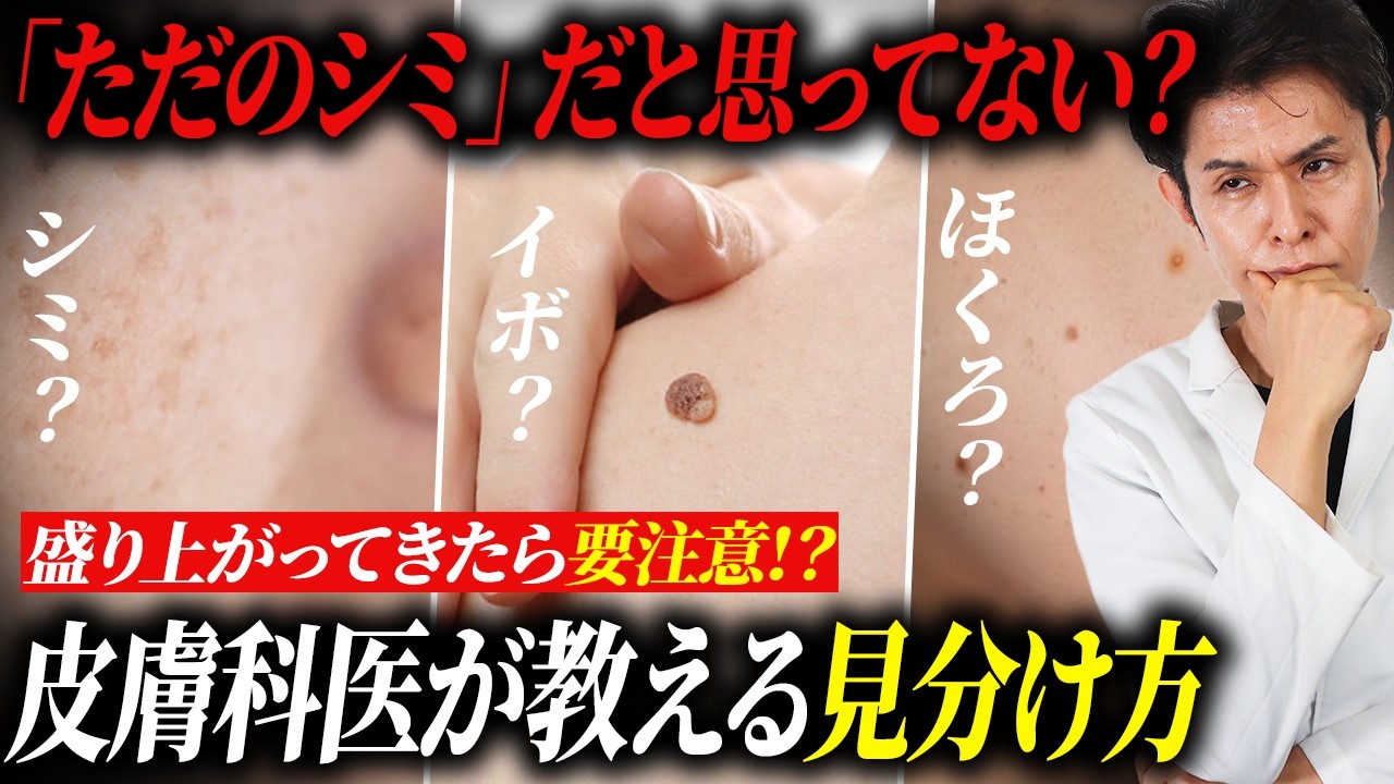 それ、本当にシミ？皮膚科医が教える「シミ・ほくろ・イボ」の見分け方完全ガイド