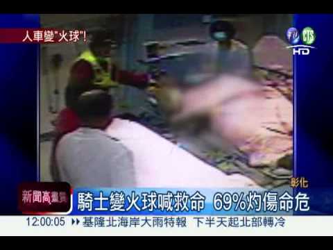 機車對撞漏油起火 騎士燒傷命危