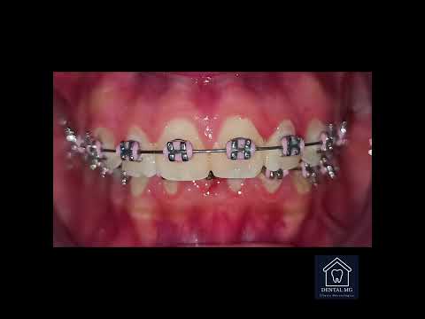 Daniel Mares-8