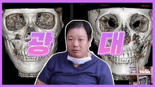 황원장님과 함께 하는 광대수술의 거짓과 진실