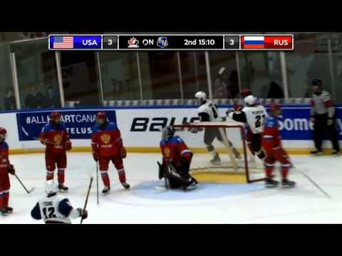 Dec 17, 2015 WJAC: 1/2. USA 4-7 Russia