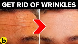 14 Ways To Get Rid Of Wrinkles On Your Forehead Naturally