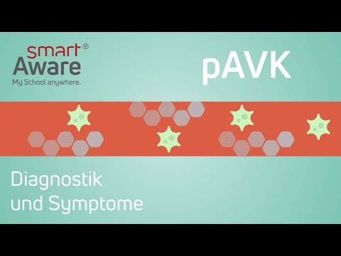 Periphere arterielle Verschlusskrankheit: Diagnostik und Symptome | Fachfortbildungen | smartAware