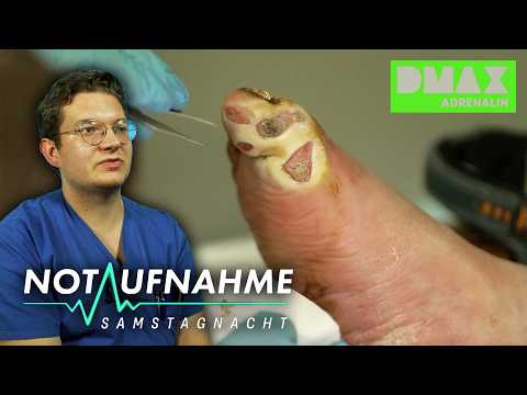 Maden Alarm: Muss der Fuß ab? 🦶🫢 | COMPILATION | Notaufnahme: Samstagnacht | DMAX Adrenalin