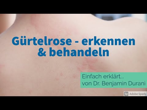 Shingles - recognize & treat - Simply explained by Dr. Durani (dermatologist)