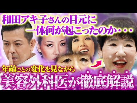 【眼瞼下垂】和田アキ子さんの目元についてプロが徹底解説。解剖学的に必要だった正しい治療と避けるべきだった治療方針をお伝えします。【再生治療？】