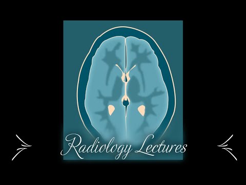 How to perform emergency Ultrasound in Shock Patients. RUSH Protocol.