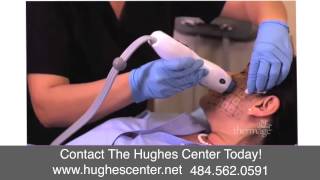 preview picture of video 'Coolsculpting Bala Cynwyd PA Hughes Center'