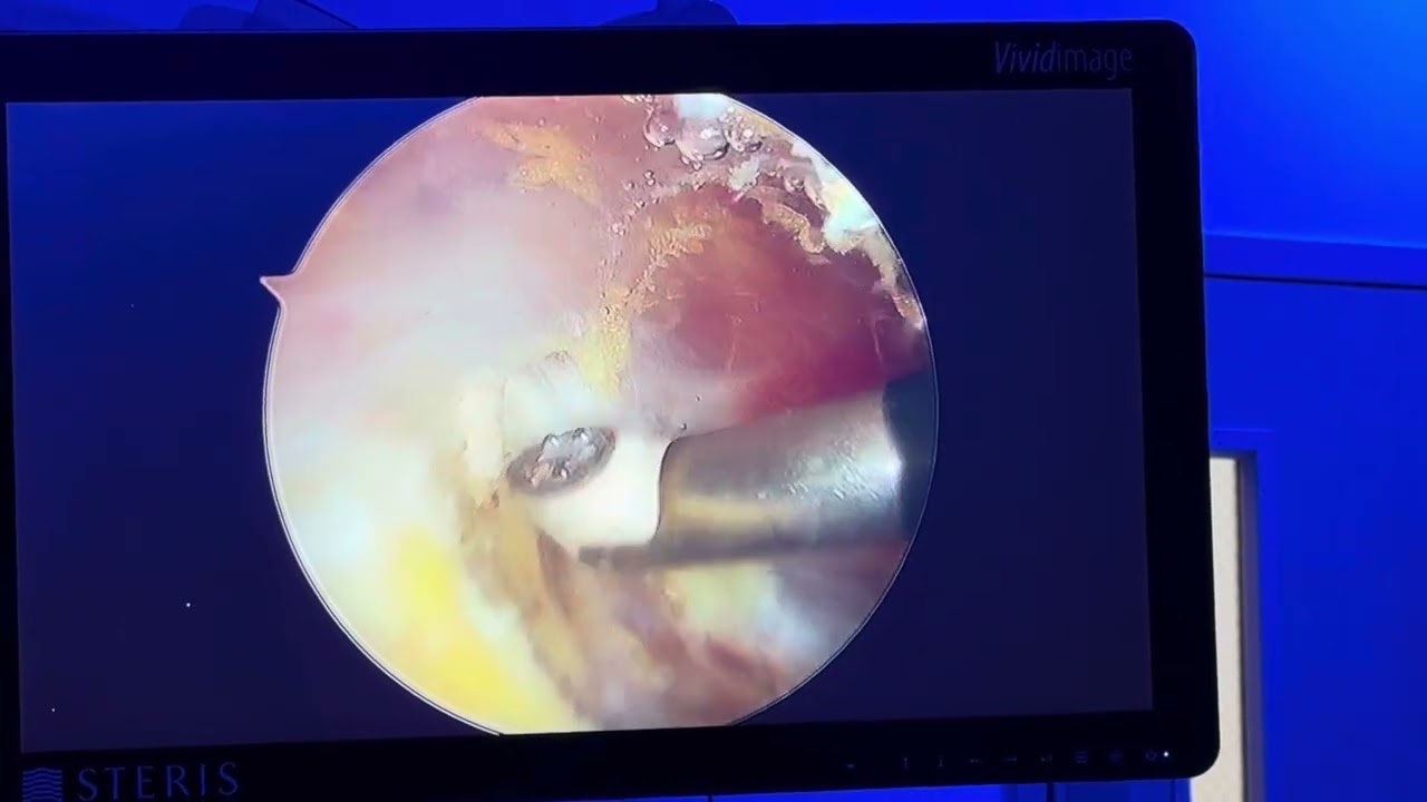 Luis Alfredo Miranda Ocaña-21