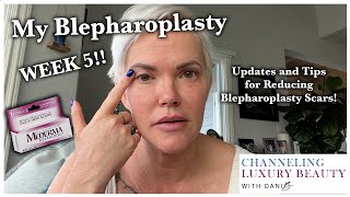 Blepharoplasty Update Week 5! Scars, Recovery, Bruising, Update Eyelid Surgery! CO2 Laser & Scar Gel