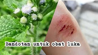 Download lagu BANDOTAN | BABADOTAN | manfaat daun bandotan untuk pengobatan atau obat luka mp3 Download lagu BANDOTAN | BABADOTAN | manfaat daun bandotan untuk pengobatan atau obat luka mp3