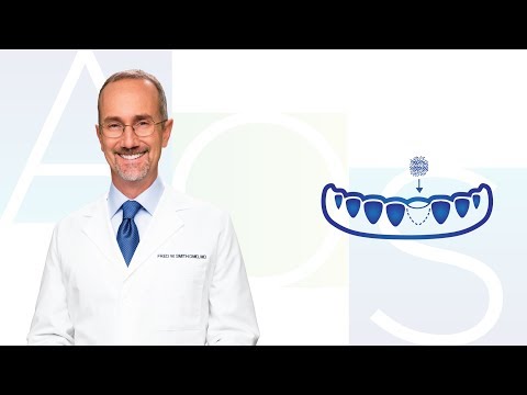 Bone Grafting at Alexandria Oral Surgery , Alexandria, LA
