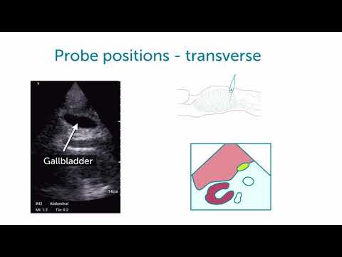Views of Gallbladder Ultrasound and Bile Duct Imaging