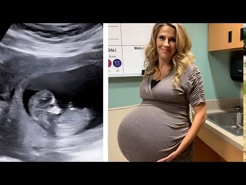 Girl visits the doctor he calls the cops after seeing the ultrasound