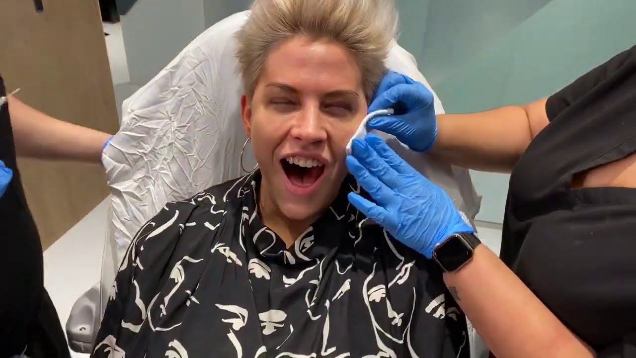 I DID CHEEK FILLER AND THIS HAPPENED | FEMALE FACIAL SCULPTING + FACE SLIMMING | Dr. Jason Emer