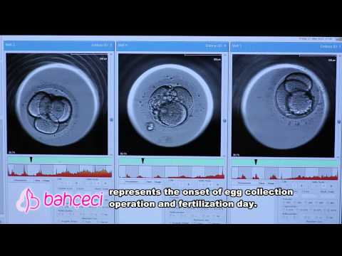 What are the stages of embryo progression?