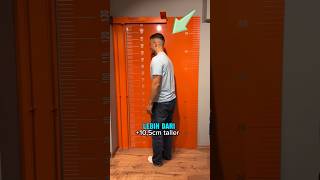 Download lagu Cara menambah tinggi badan dengan operasi mp3 Download lagu Cara menambah tinggi badan dengan operasi mp3