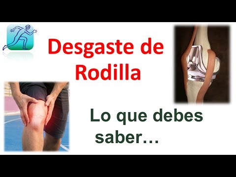 Desgaste de la Rodilla