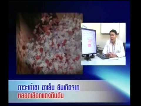 แชมพูสำหรับโรคสะเก็ดเงินด้วยตัว e ปัสสาวะการรักษากลาก