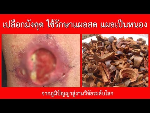 ยาเสพติดจาก neurodermatitis เยื่อกระดาษที่ใช้สำหรับ neurodermatitis